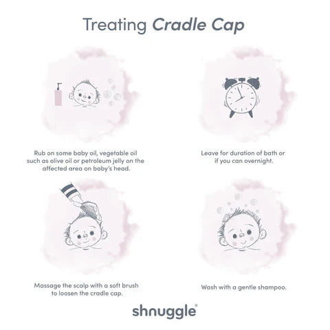 Tips on treating cradle cap